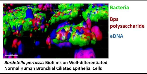 NHBE biofilms CSLM