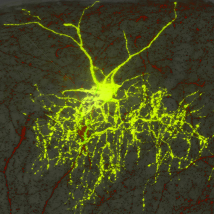Chandelier cells and cholinergic fibers in the developing mouse brain