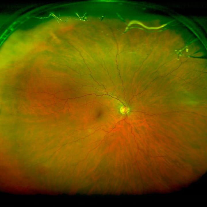 Retina Research