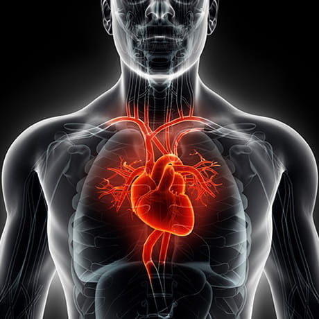 Lampert_HeartFailure