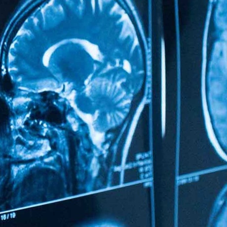 Neuro-Brain