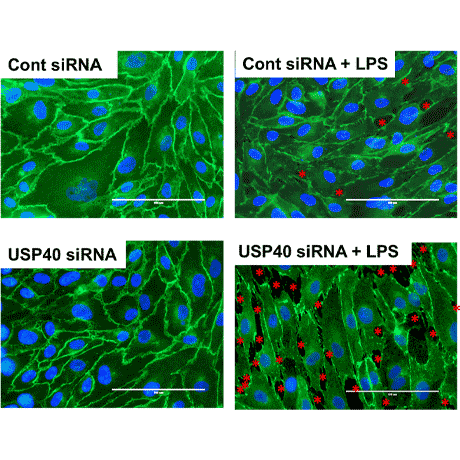 siRNA diagram