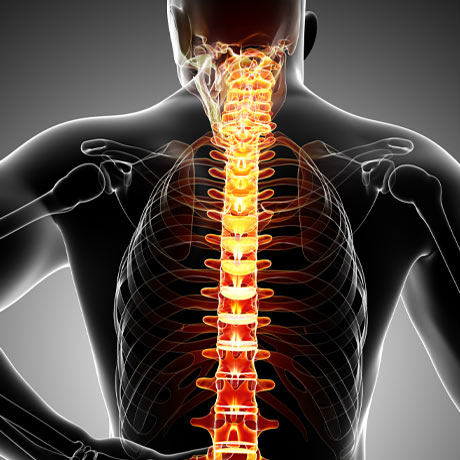 Spine-Injury