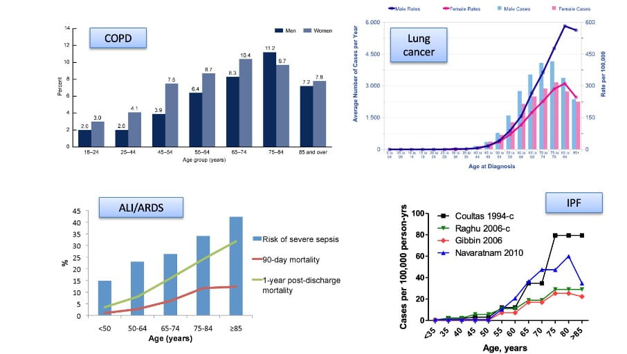 Four graphs depicting lung aging  for COPD, Lung cancer, ALI/ ARDS and IPF. 