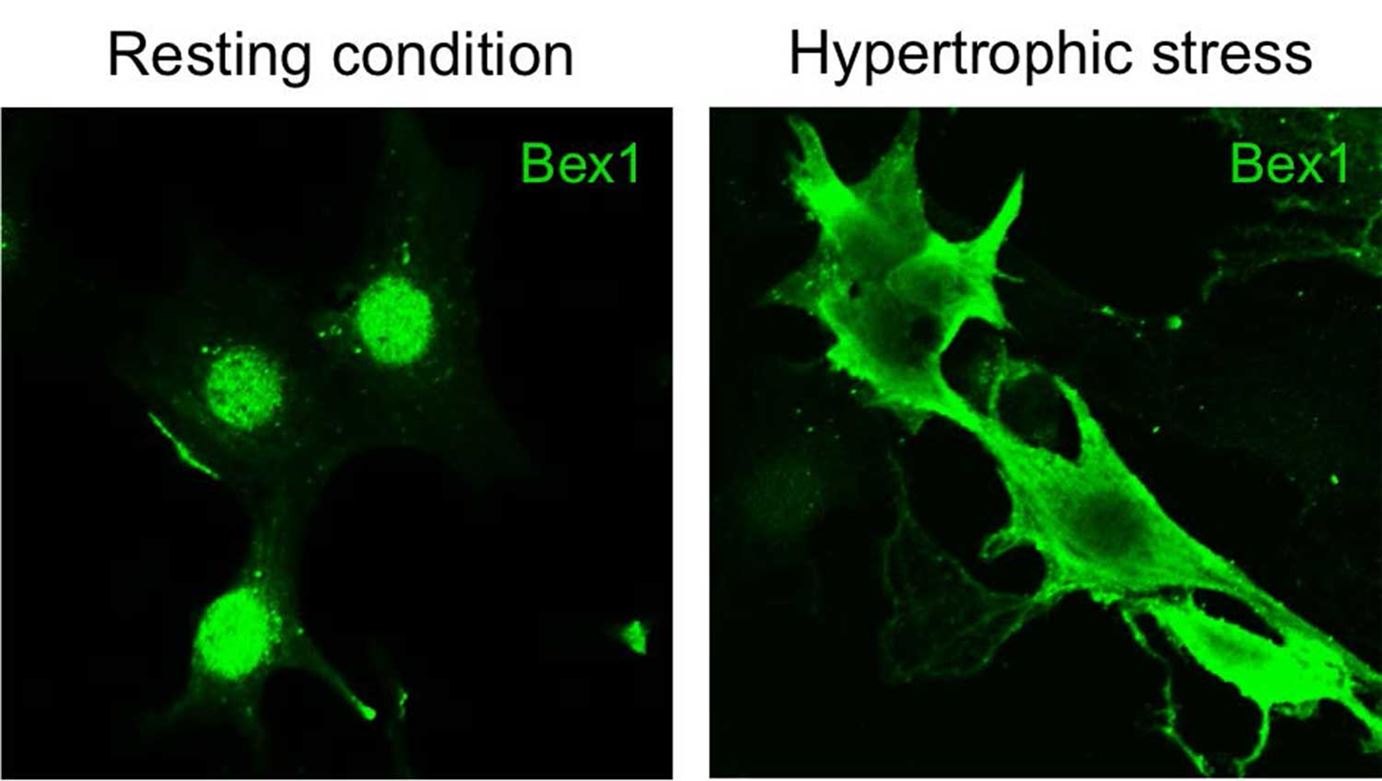 Resting condition vs hypertrophic stress