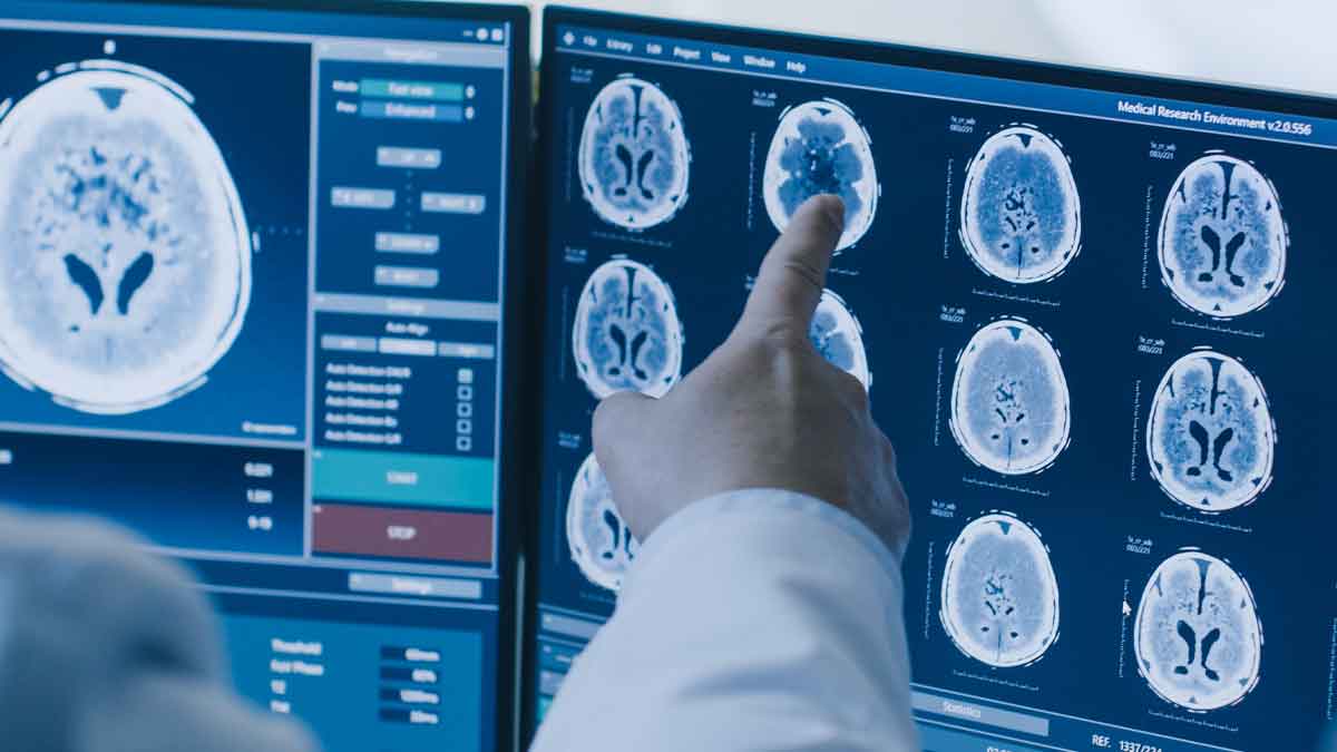 Researcher reviewing brain scans on screen
