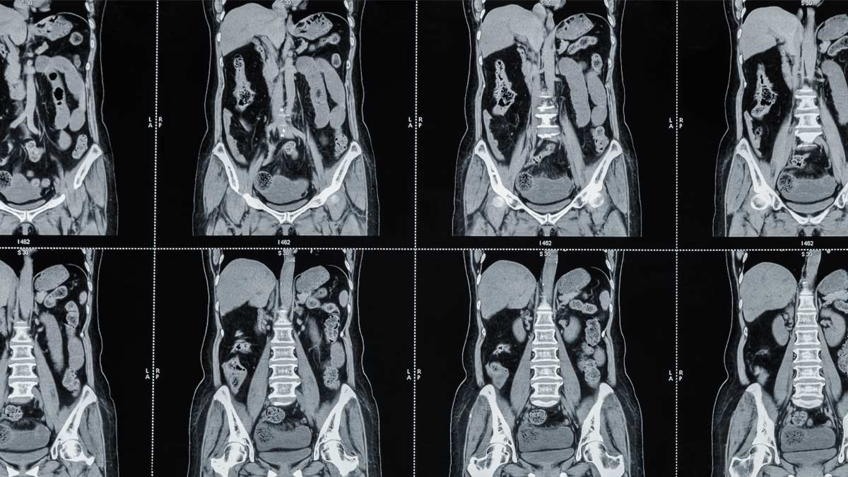 Abdominal imaging scans
