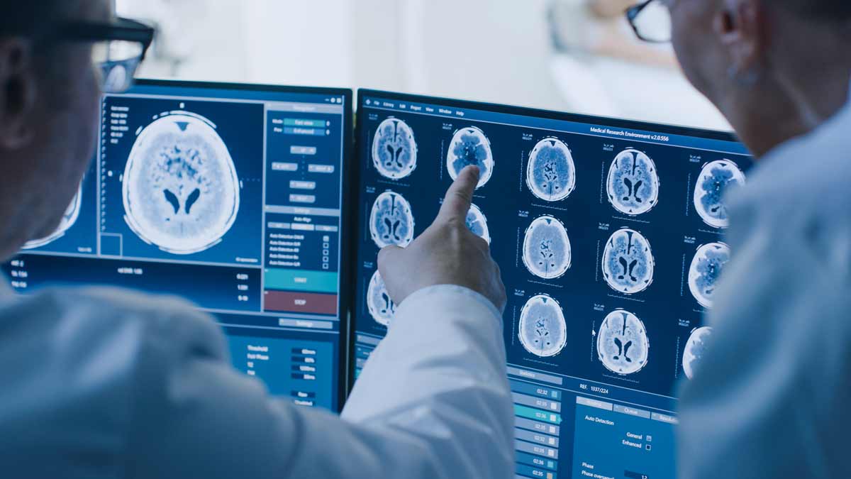 Doctors reviewing MRI