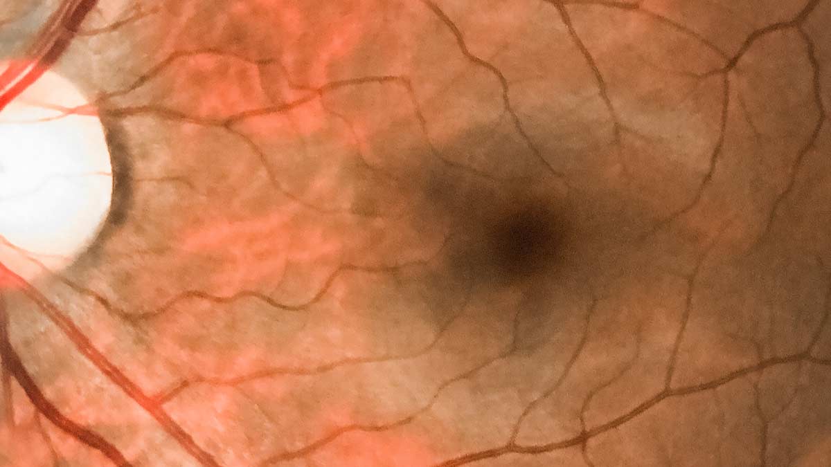 Retinal tissue