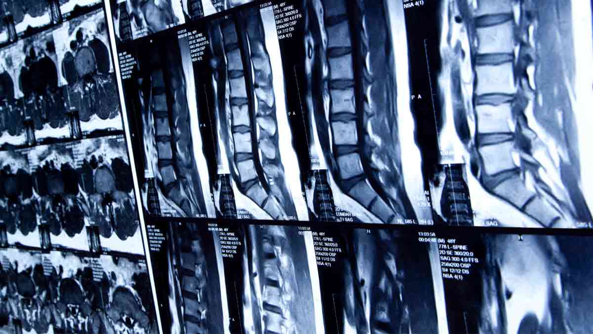 Spine-Imaging