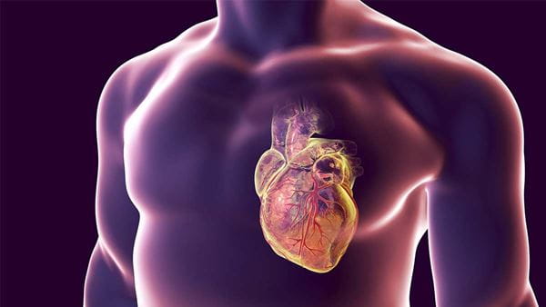 Heart muscle showing adipose tissue
