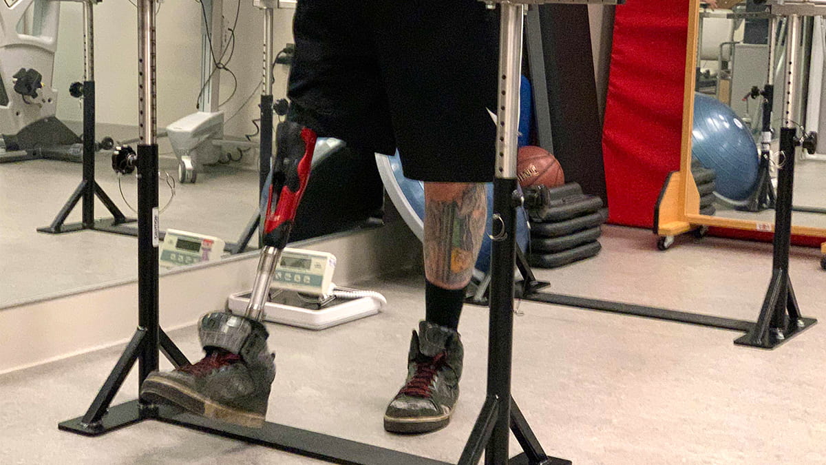 Patient with prosthetic leg