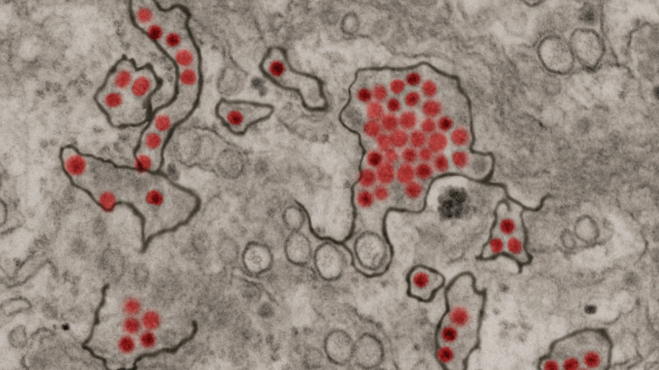 zika virus