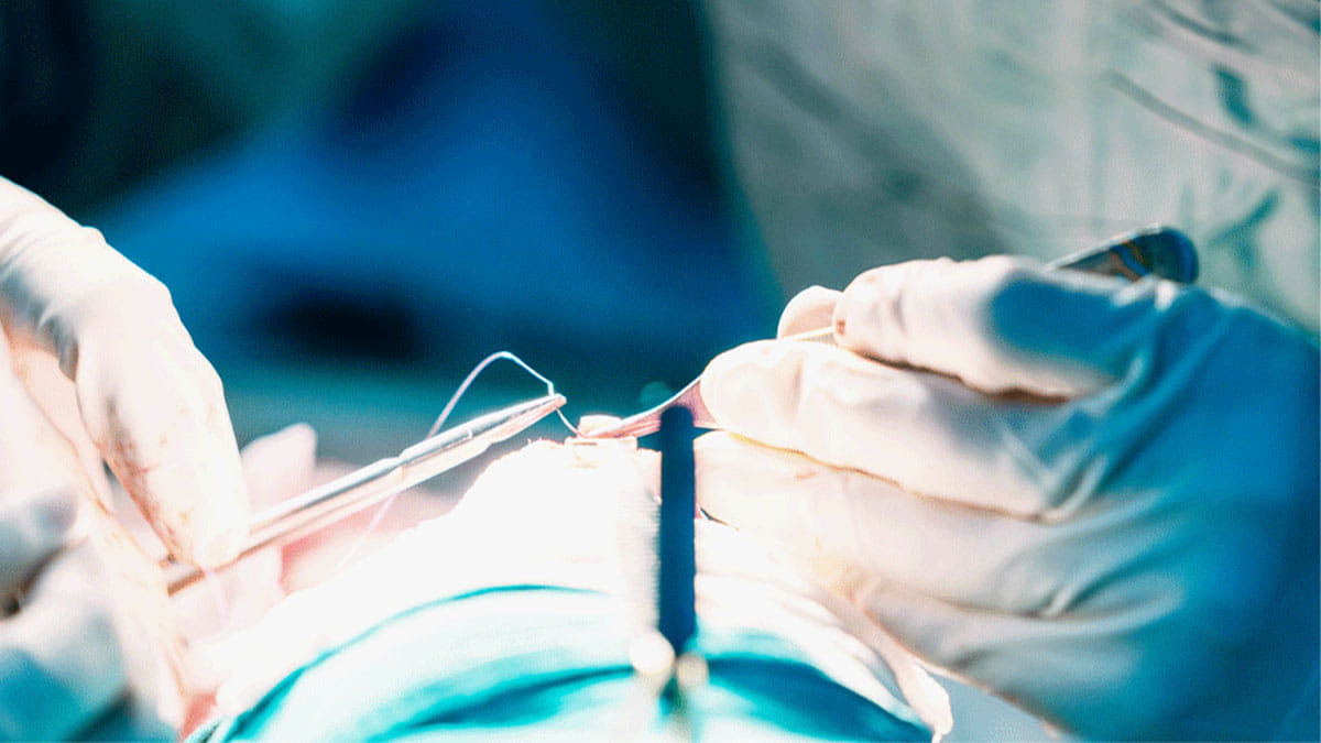 Image of a doctor using stitches to close a wound