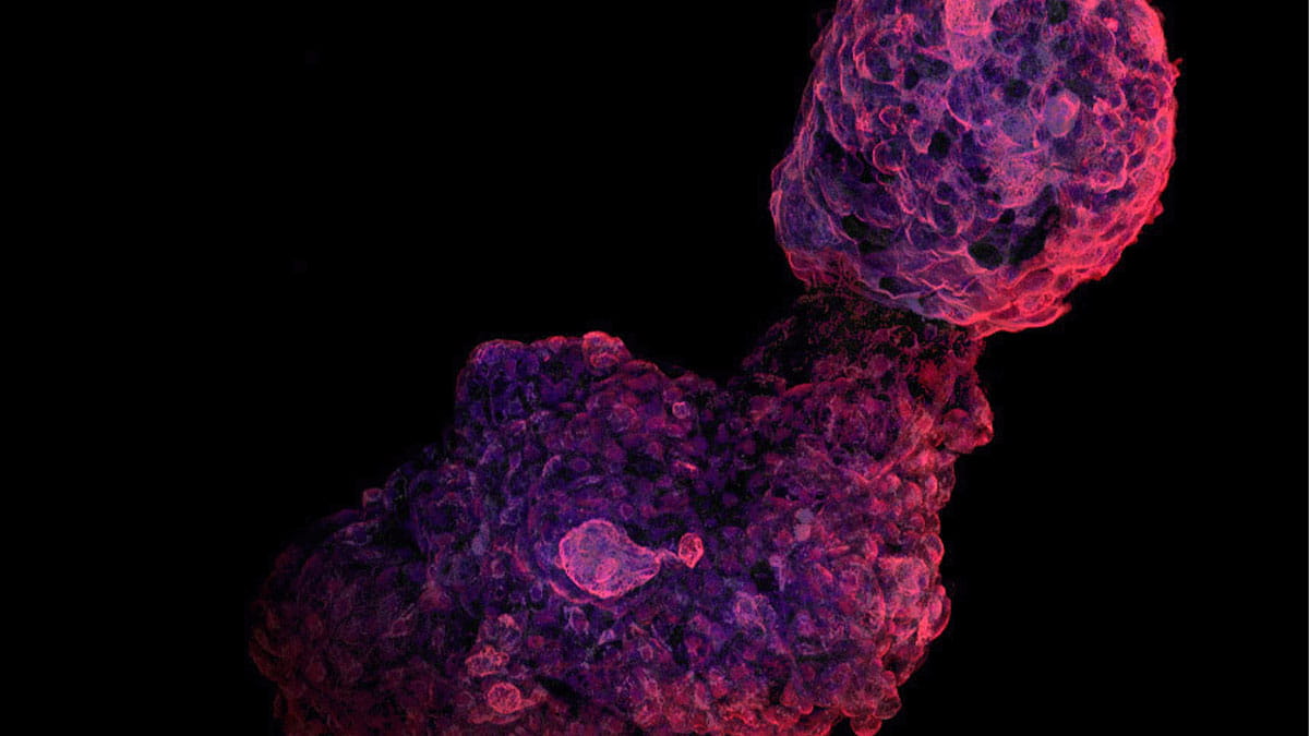 Human iPSC-derived cardiac organoid