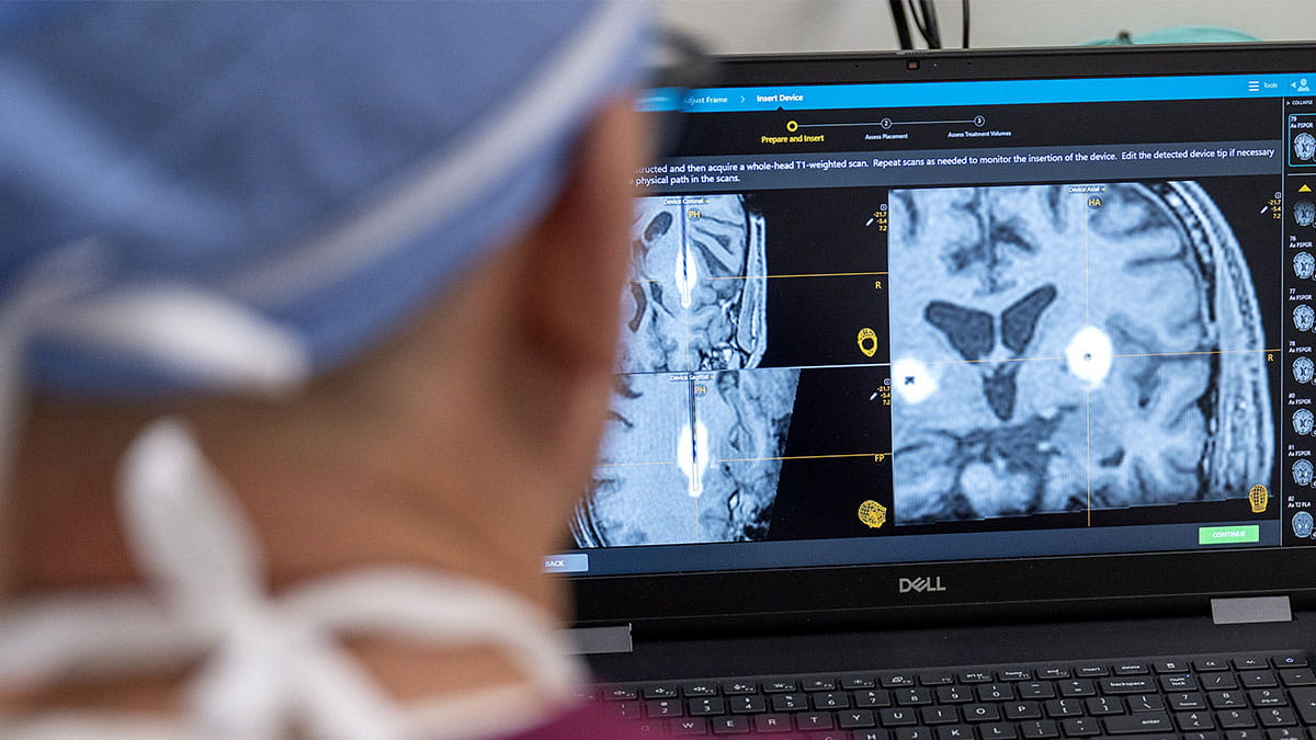 A healthcare professional in surgical attire examines brain MRI scans on a laptop screen, showing detailed brain structures and graphical elements, in a medical setting.