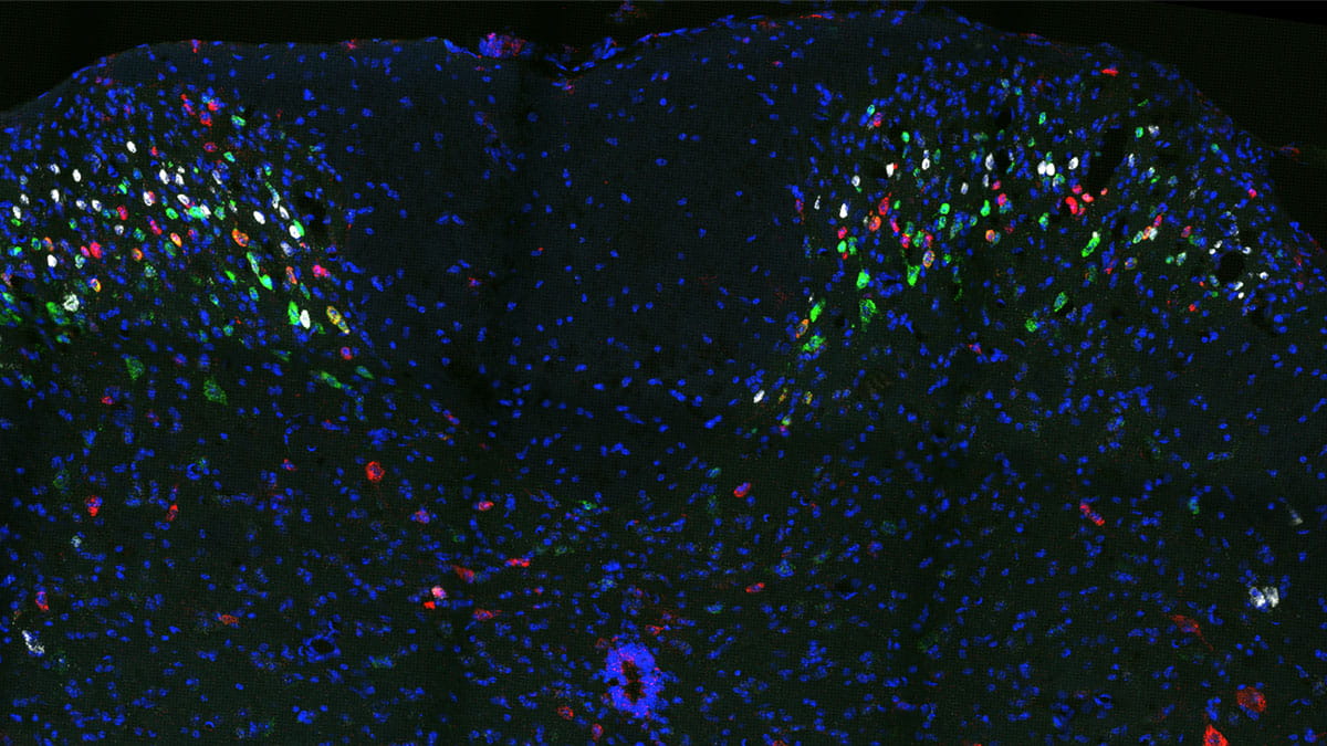 red activated neurons in mouse spinal cord, 