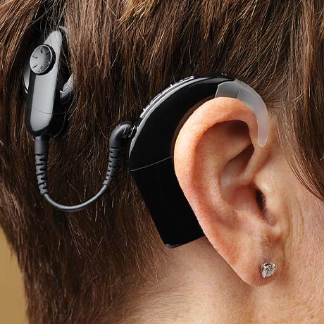 Cochlear Implant