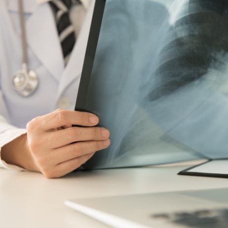 Lung Transplant