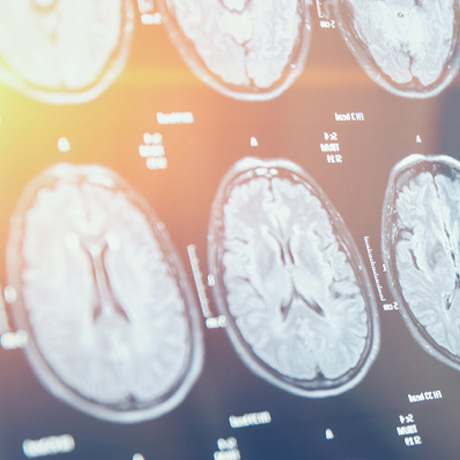 Brain Imaging