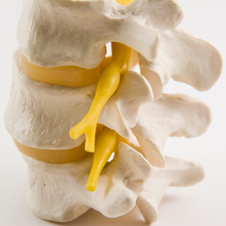 Spine Model_460