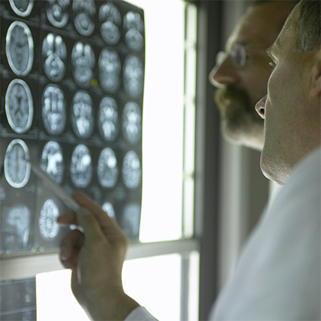BrainFeature