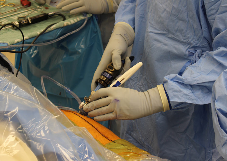 Hip Surgery | Ohio State Medical Center