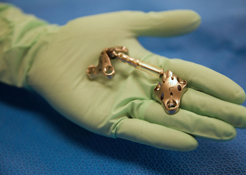 ClinicalTrialForKneeDevice