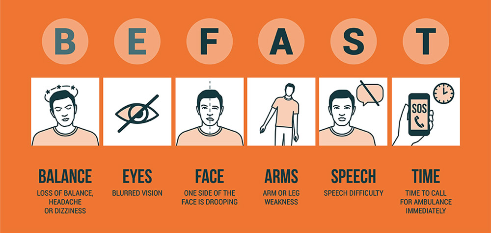 StrokeBEFASTinfographic