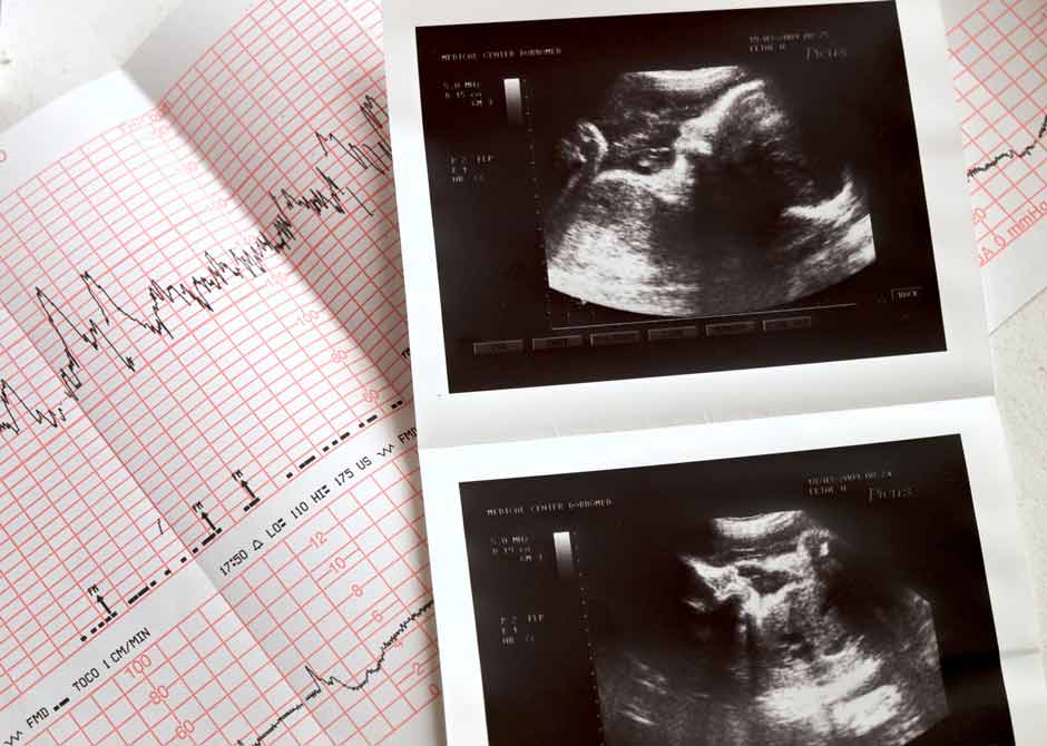 Echocardiogram and ultrasound photo