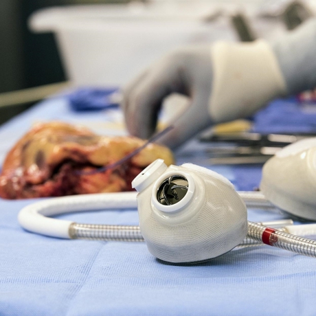 30 Artificial Heart 460x460