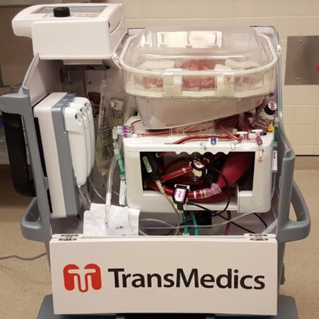 38 Liver TransMedics Trial 460x460