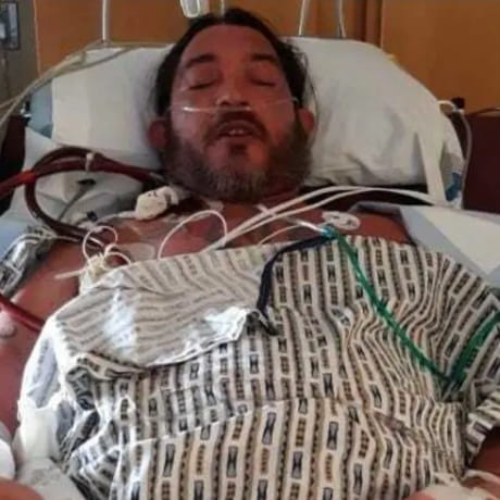 53 COVID Lung Patient