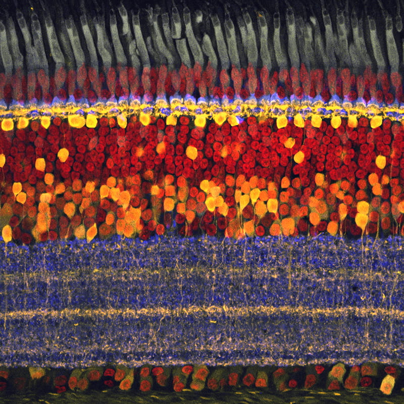 retina under microscope